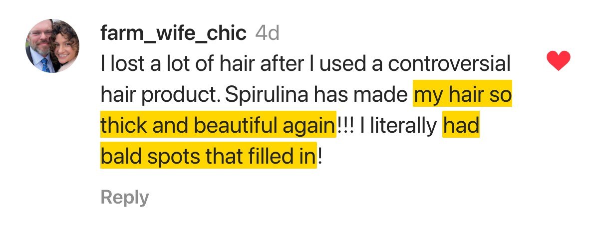 Hair testimonial — Spirulina bald spots